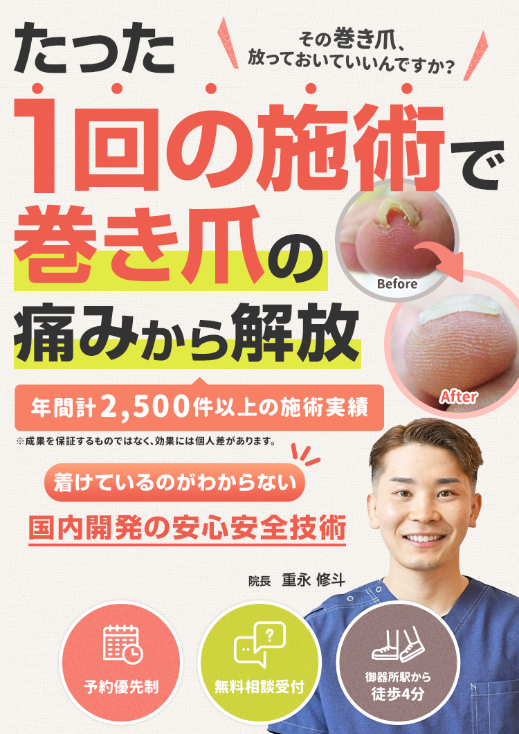 たった1回の施術で巻き爪の痛みから解放